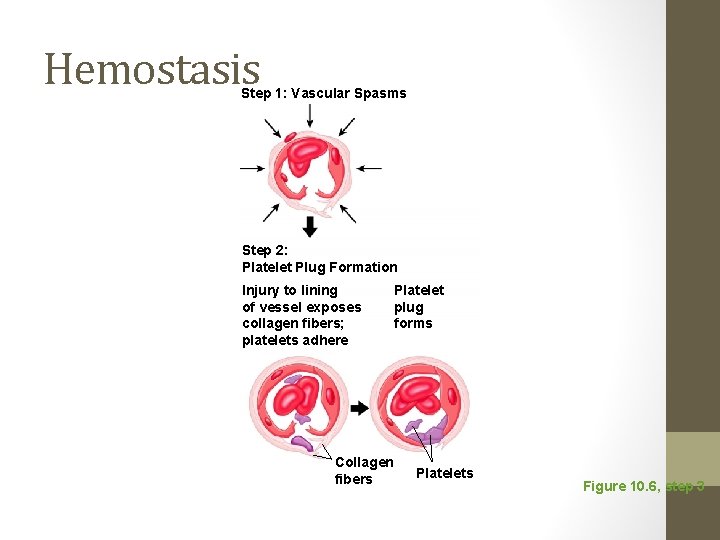 Hemostasis Step 1: Vascular Spasms Step 2: Platelet Plug Formation Injury to lining of