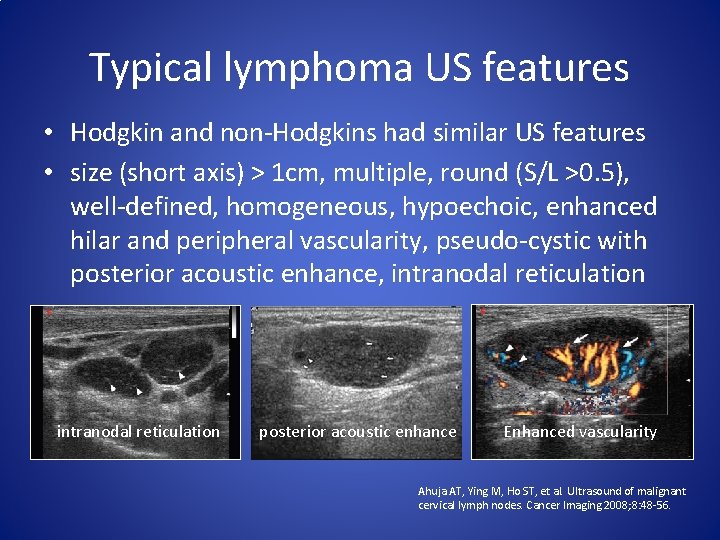 Typical lymphoma US features • Hodgkin and non-Hodgkins had similar US features • size