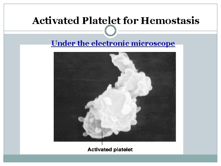 Activated Platelet for Hemostasis Under the electronic microscope 