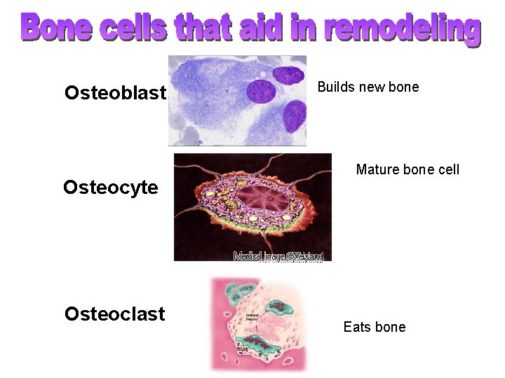 Osteoblast Osteocyte Osteoclast Builds new bone Mature bone cell Eats bone 