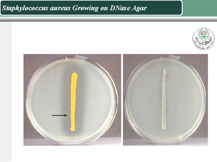 Staphylococcus aureus Growing on DNase Agar 