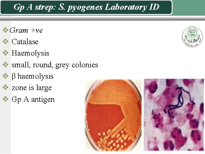 Gp A strep: S. pyogenes Laboratory ID v Gram +ve v Catalase v Haemolysis