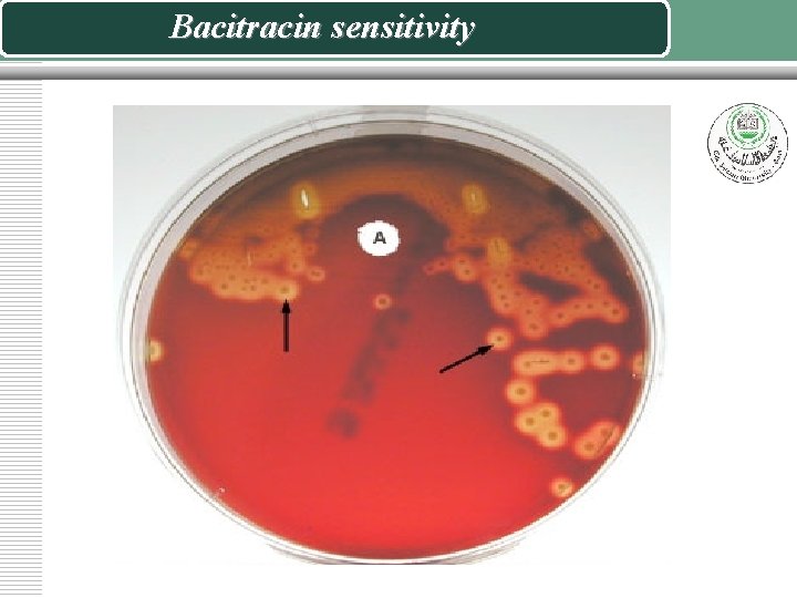 Bacitracin sensitivity 