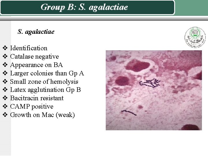 Group B: S. agalactiae v Identification v Catalase negative v Appearance on BA v