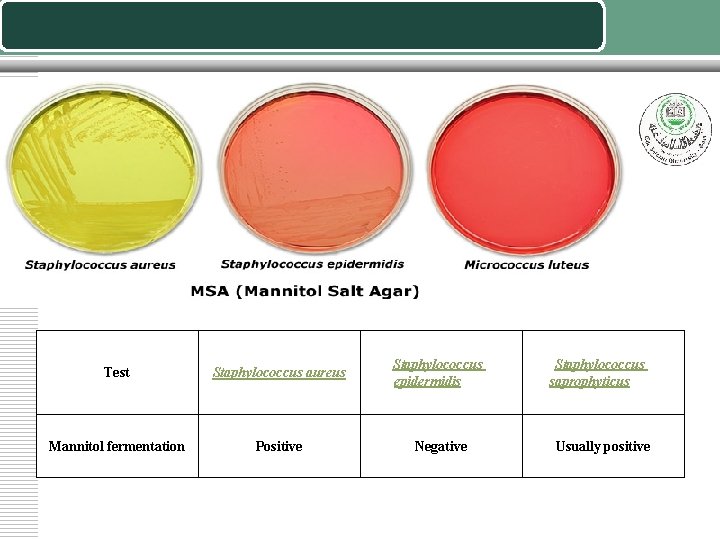 Test Staphylococcus aureus Staphylococcus epidermidis Mannitol fermentation Positive Negative Staphylococcus saprophyticus Usually positive 