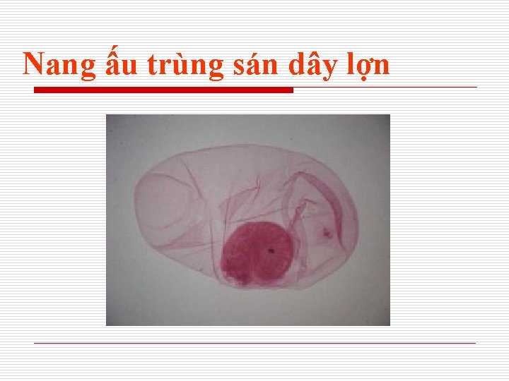 Nang ấu trùng sán dây lợn 