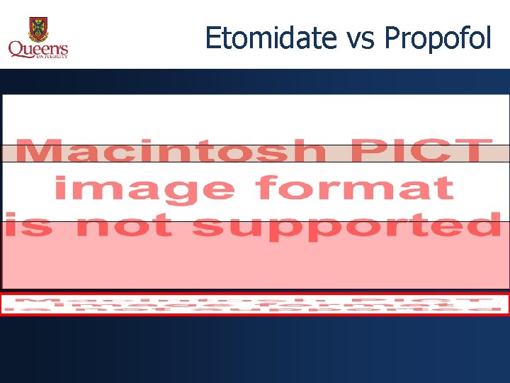 Etomidate vs Propofol 