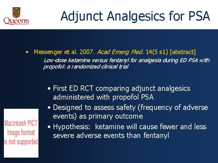 Adjunct Analgesics for PSA • Messenger et al. 2007. Acad Emerg Med. 14(5 s