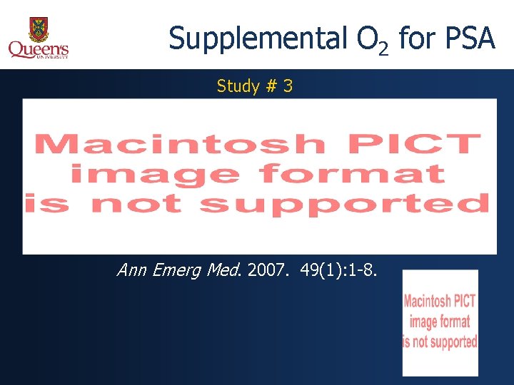 Supplemental O 2 for PSA Study # 3 Ann Emerg Med. 2007. 49(1): 1