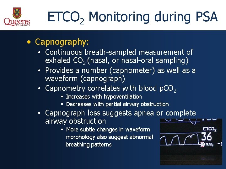 ETCO 2 Monitoring during PSA • Capnography: • Continuous breath-sampled measurement of exhaled CO