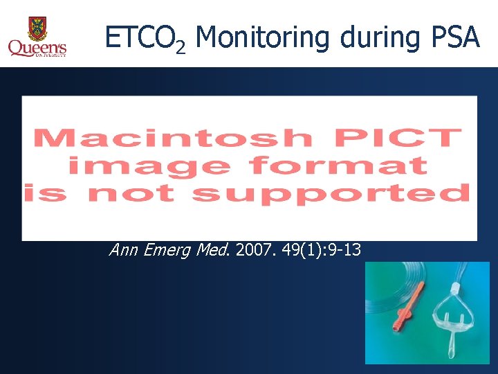 ETCO 2 Monitoring during PSA Ann Emerg Med. 2007. 49(1): 9 -13 