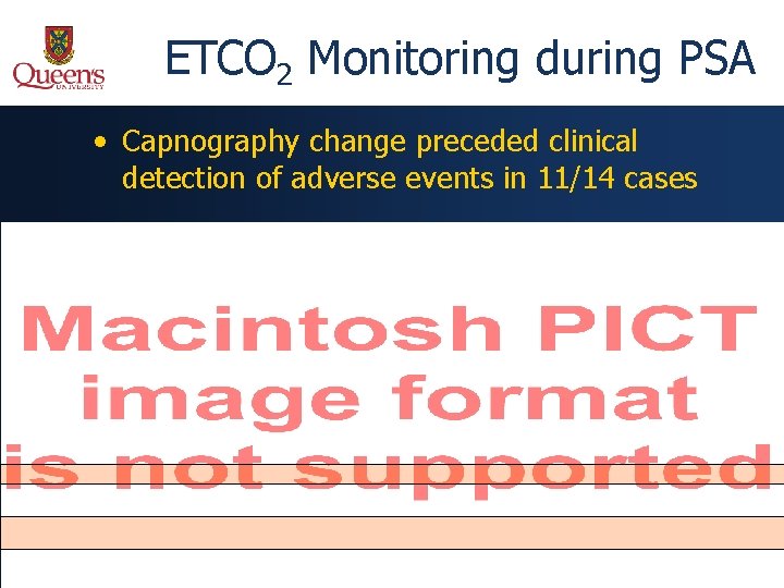 ETCO 2 Monitoring during PSA • Capnography change preceded clinical detection of adverse events