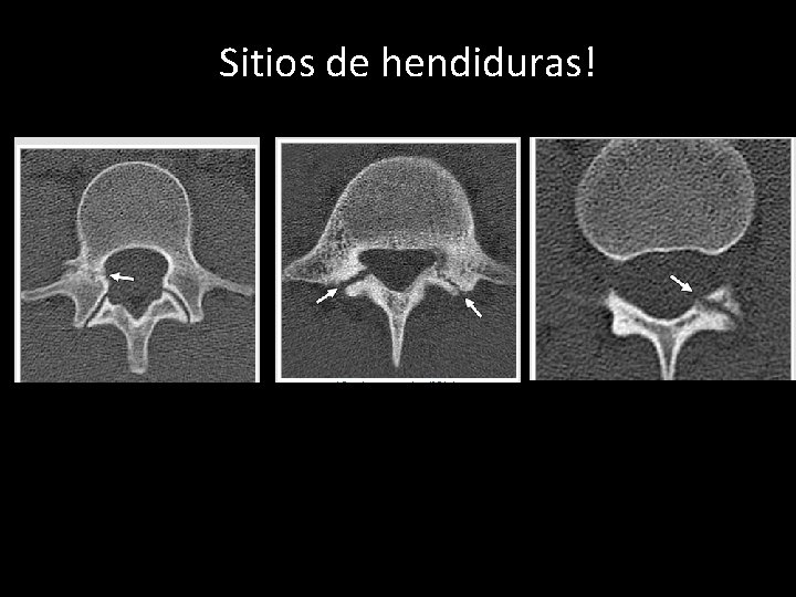 Sitios de hendiduras! 