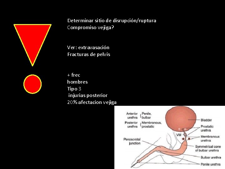 Determinar sitio de disrupción/ruptura Compromiso vejiga? Ver: extravasación Fracturas de pelvis + frec hombres