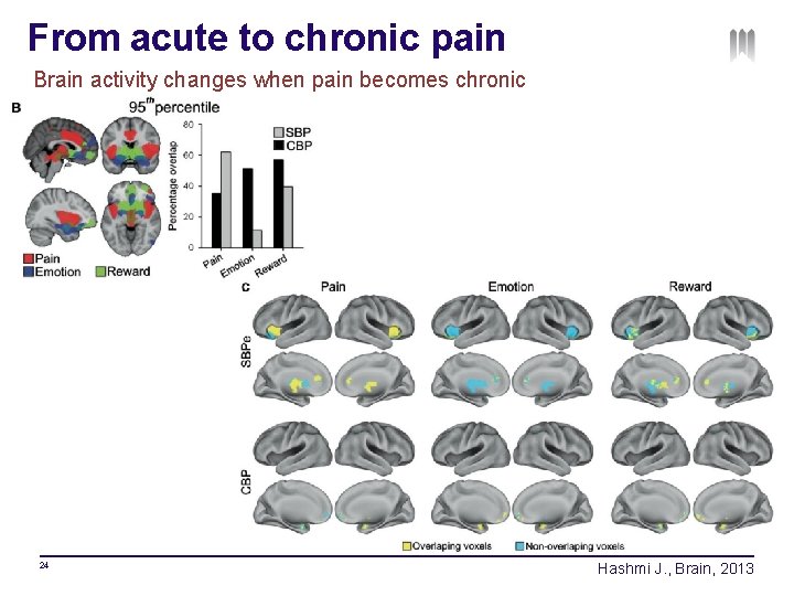 From acute to chronic pain Brain activity changes when pain becomes chronic 24 Hashmi