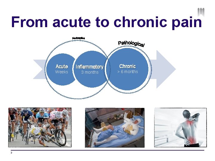 From acute to chronic pain Acute Weeks 3 Inflammatory 3 months Chronic > 6