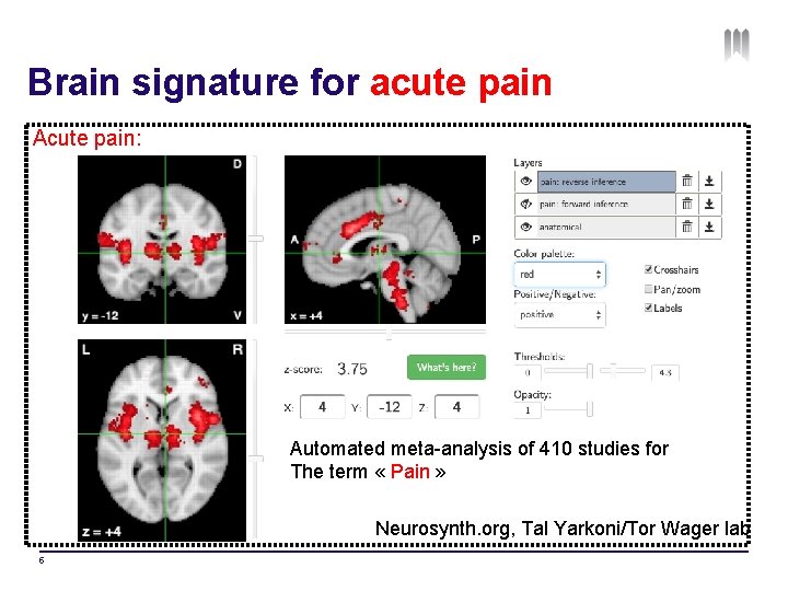 Brain signature for acute pain Acute pain: Automated meta-analysis of 410 studies for The