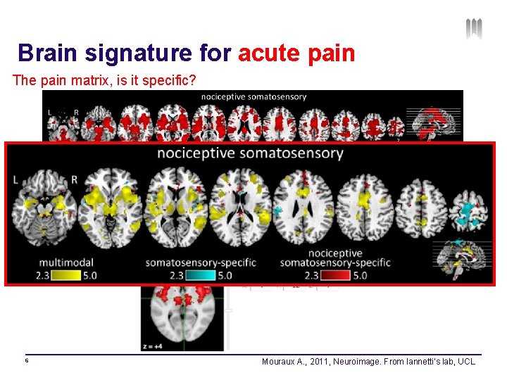 Brain signature for acute pain The pain matrix, is it specific? 6 Mouraux A.