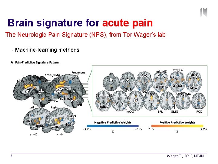 Brain signature for acute pain The Neurologic Pain Signature (NPS), from Tor Wager’s lab