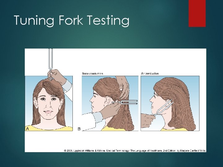 Tuning Fork Testing 