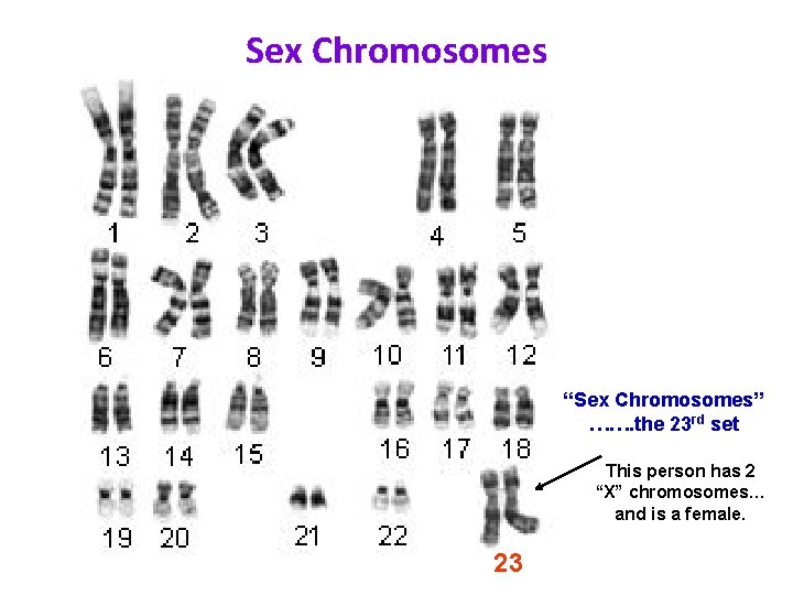 Sex Chromosomes “Sex Chromosomes” ……. the 23 rd set This person has 2 “X”