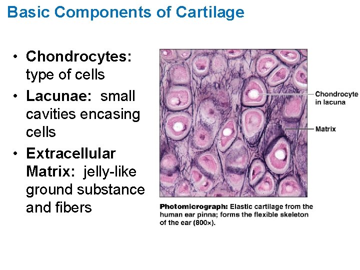 Basic Components of Cartilage • Chondrocytes: type of cells • Lacunae: small cavities encasing