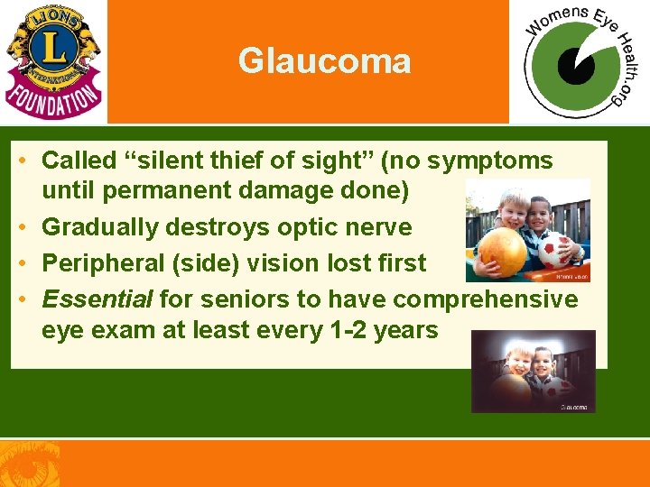 Glaucoma • Called “silent thief of sight” (no symptoms until permanent damage done) •