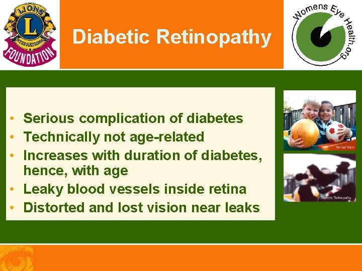 Diabetic Retinopathy • Serious complication of diabetes • Technically not age-related • Increases with