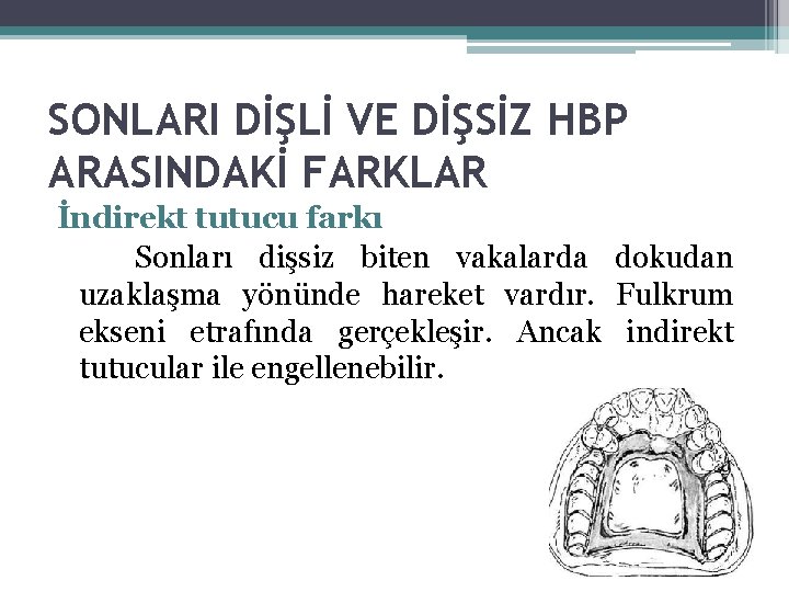 SONLARI DİŞLİ VE DİŞSİZ HBP ARASINDAKİ FARKLAR İndirekt tutucu farkı Sonları dişsiz biten vakalarda