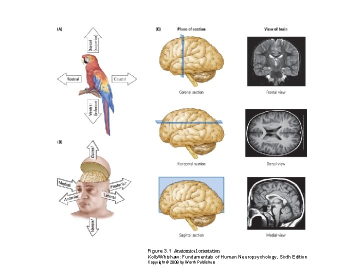 Figure 3. 1 Anatomical orientation Kolb/Whishaw: Fundamentals of Human Neuropsychology, Sixth Edition Copyright ©