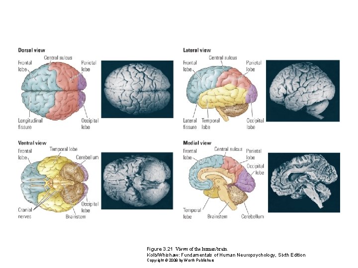 Figure 3. 21 Views of the human brain Kolb/Whishaw: Fundamentals of Human Neuropsychology, Sixth