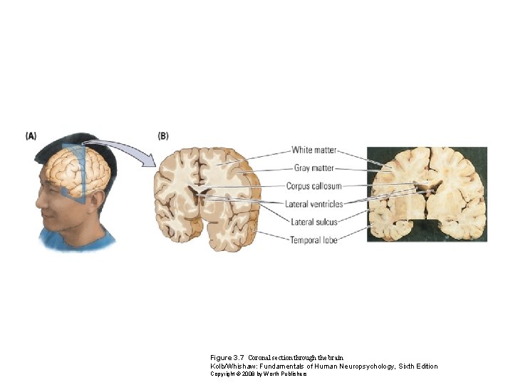 Figure 3. 7 Coronal section through the brain Kolb/Whishaw: Fundamentals of Human Neuropsychology, Sixth