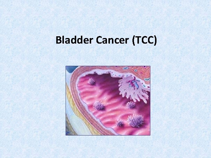 Bladder Cancer (TCC) 
