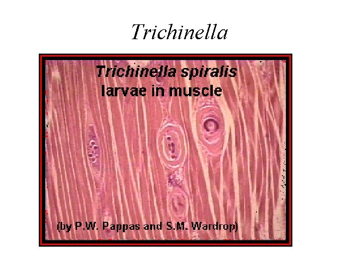 Trichinella 