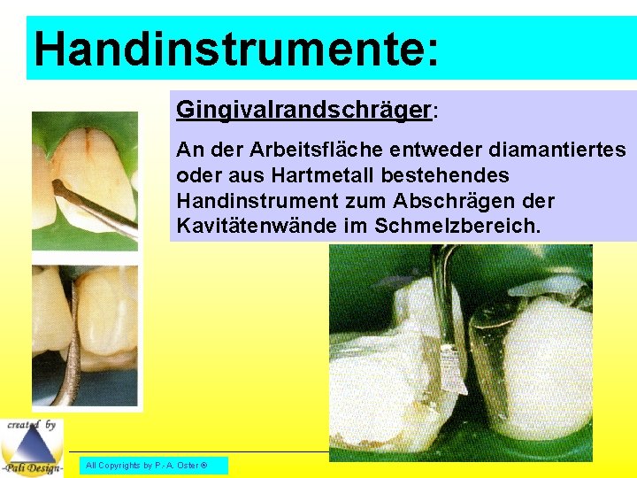 Handinstrumente: Gingivalrandschräger: An der Arbeitsfläche entweder diamantiertes oder aus Hartmetall bestehendes Handinstrument zum Abschrägen