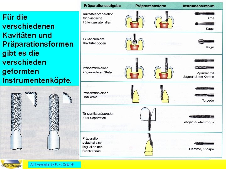 Für die verschiedenen Kavitäten und Präparationsformen gibt es die verschieden geformten Instrumentenköpfe. All Copyrights