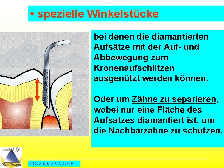  • spezielle Winkelstücke bei denen die diamantierten Aufsätze mit der Auf- und Abbewegung