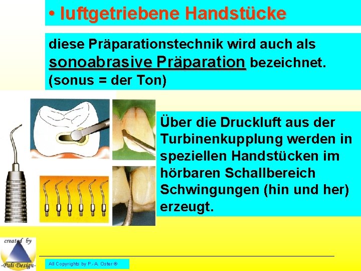  • luftgetriebene Handstücke diese Präparationstechnik wird auch als sonoabrasive Präparation bezeichnet. (sonus =