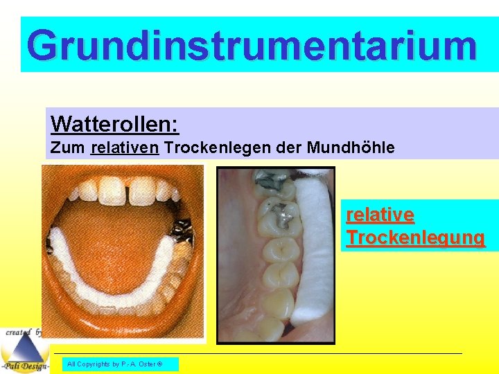 Grundinstrumentarium Watterollen: Zum relativen Trockenlegen der Mundhöhle relative Trockenlegung All Copyrights by P. -A.