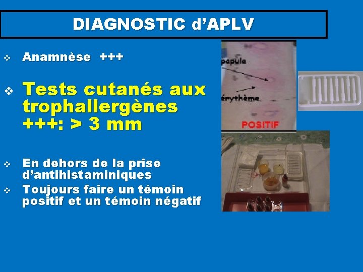 DIAGNOSTIC d’APLV v v Anamnèse +++ Tests cutanés aux trophallergènes +++: > 3 mm