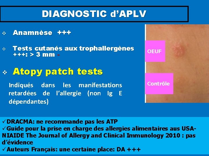 DIAGNOSTIC d’APLV v Anamnèse +++ v Tests cutanés aux trophallergènes +++: > 3 mm