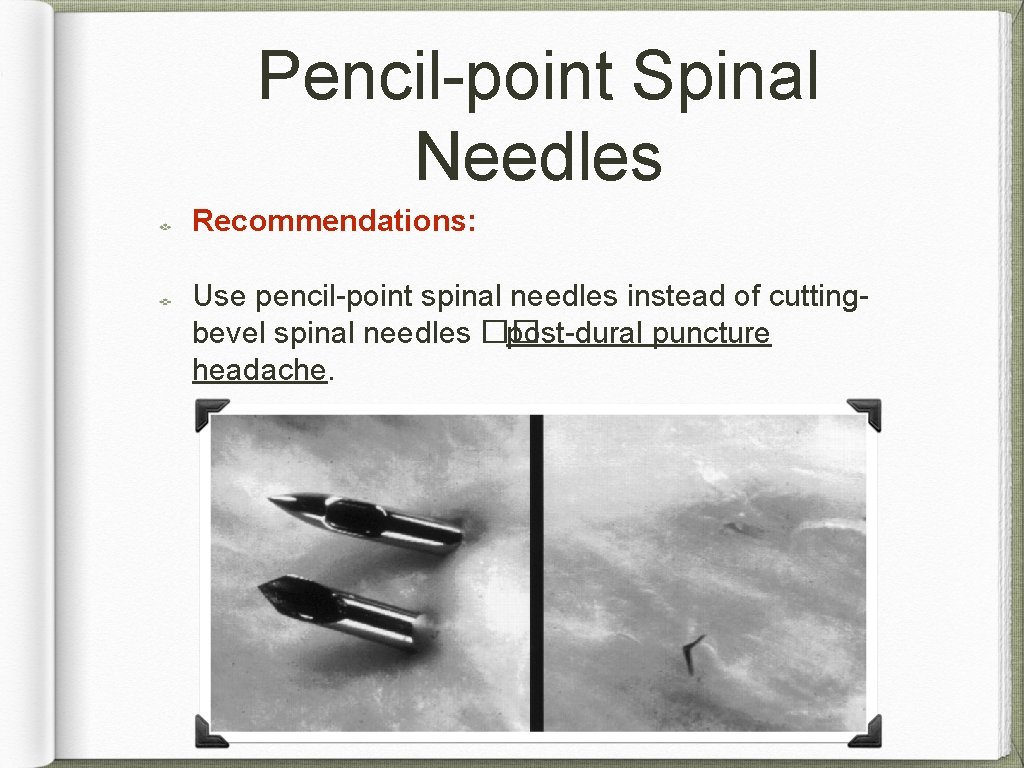 Pencil-point Spinal Needles Recommendations: Use pencil-point spinal needles instead of cuttingbevel spinal needles ��