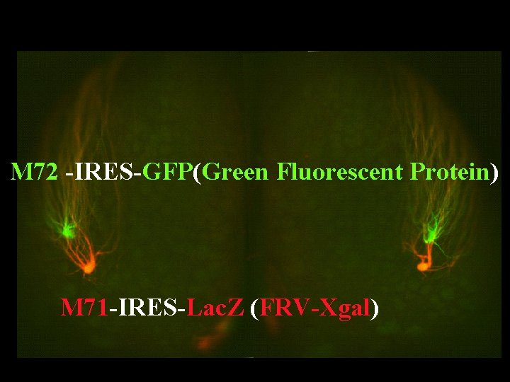 M 72 -IRES-GFP(Green Fluorescent Protein) M 71 -IRES-Lac. Z (FRV-Xgal) 