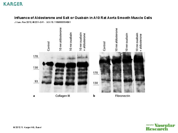 Influence of Aldosterone and Salt or Ouabain in A 10 Rat Aorta Smooth Muscle