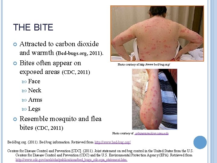 Photo courtesy of http www bedbug org BED
