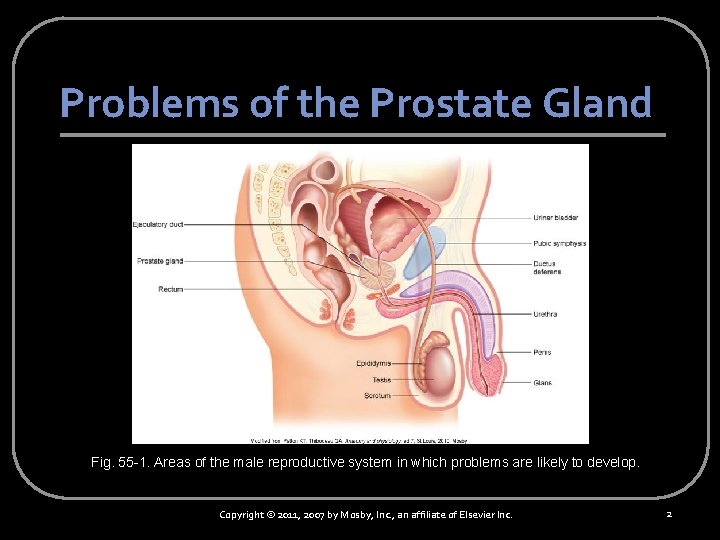 Problems of the Prostate Gland Fig. 55 -1. Areas of the male reproductive system