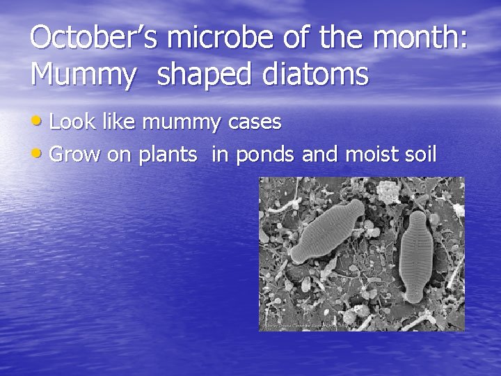 October’s microbe of the month: Mummy shaped diatoms • Look like mummy cases •