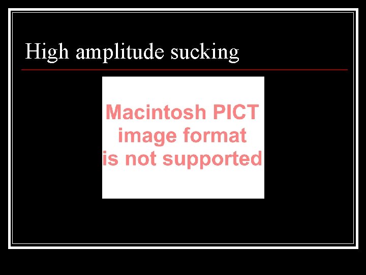 High amplitude sucking 