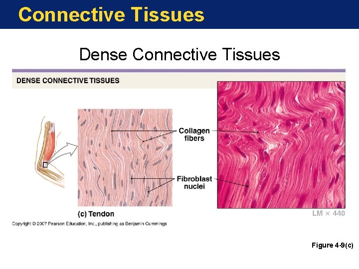 Connective Tissues Dense Connective Tissues Figure 4 -9(c) 
