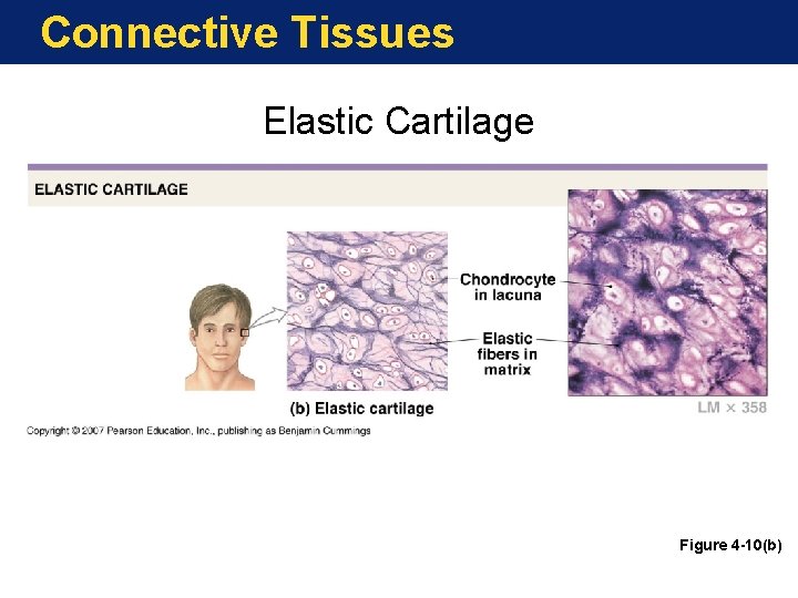 Connective Tissues Elastic Cartilage Figure 4 -10(b) 